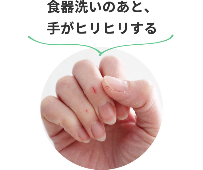 ・食器洗いのあと、手がヒリヒリする